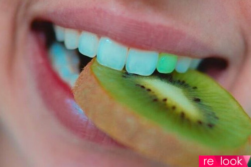 Будь в тренде: цветные зубы